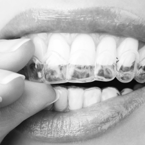 New-Dentures-and-Beauty