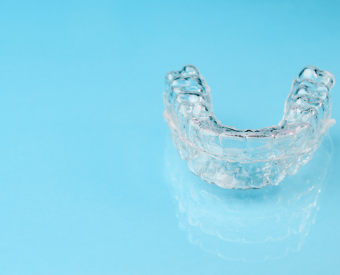 invisible-aligners